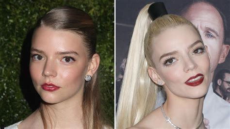 anya taylor-joy surgery|Did Anya Taylor